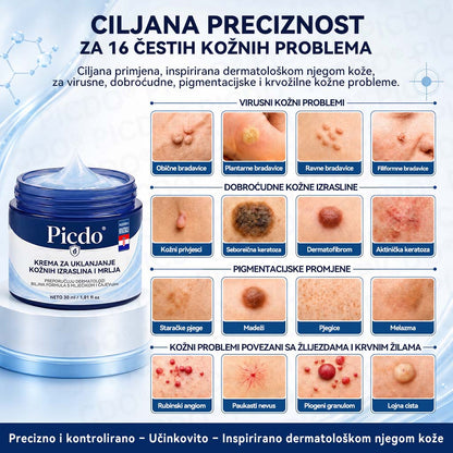 🧑‍⚕️ 𝐒𝐨𝐥𝐚𝐫𝐨𝐳𝐚® 7-Day Skin Tag & Pigmentation Removal Cream (Painless Formula – Scar-Free) 🇬🇧🧊🧊