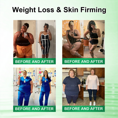 𝐈𝐧𝐬𝐋𝐞𝐦𝐨𝐧® 𝗠𝗼𝗿𝗶𝗻𝗴𝗮 × 𝗕𝗲𝗿𝗯𝗲𝗿𝗶𝗻𝗲 × 𝗔𝗠𝗣𝗞 𝟭𝟬-𝗶𝗻-𝟭 𝗠𝗲𝘁𝗮𝗯𝗼𝗹𝗶𝗰 𝗦𝘂𝗽𝗽𝗼𝗿𝘁 𝗡𝗮𝗻𝗼 𝗠𝗶𝗰𝗿𝗼𝗻𝗲𝗲𝗱𝗹𝗲 𝗣𝗮𝘁𝗰𝗵🇬🇧(𝐉𝐮𝐬𝐭 𝐨𝐧𝐜𝐞 𝐚 𝐝𝐚𝐲, 𝐯𝐢𝐬𝐢𝐛𝐥𝐞 𝐜𝐡𝐚𝐧𝐠𝐞𝐬 𝐢𝐧 𝟕 𝐝𝐚𝐲𝐬） ✅ 𝐅𝐨𝐫 𝐨𝐛𝐞𝐬𝐢𝐭𝐲, 🅛🅞🅞🅢🅔 🅢🅚🅘🅝, 𝐝𝐢𝐚𝐛𝐞𝐭𝐞𝐬, 𝐬𝐥𝐞𝐞𝐩 𝐚𝐩𝐧𝐞𝐚, 𝐣𝐨𝐢𝐧𝐭 𝐢𝐬𝐬𝐮𝐞𝐬, 𝐚𝐧𝐝 𝐦𝐨𝐫𝐞⭐⭐⭐⭐⭐