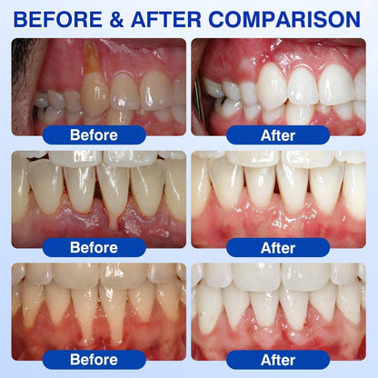 🇬🇧🏆🦷🛡️ Dr.Era® GumRevive Advanced Gum & Periodontal Repair Gel 💫💫