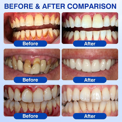🇬🇧🏆🦷🛡️ Dr.Era® GumRevive Advanced Gum & Periodontal Repair Gel 💫💫