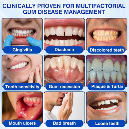 🇬🇧🏆🦷🛡️ Dr.Era® GumRevive Advanced Gum & Periodontal Repair Gel 💫💫