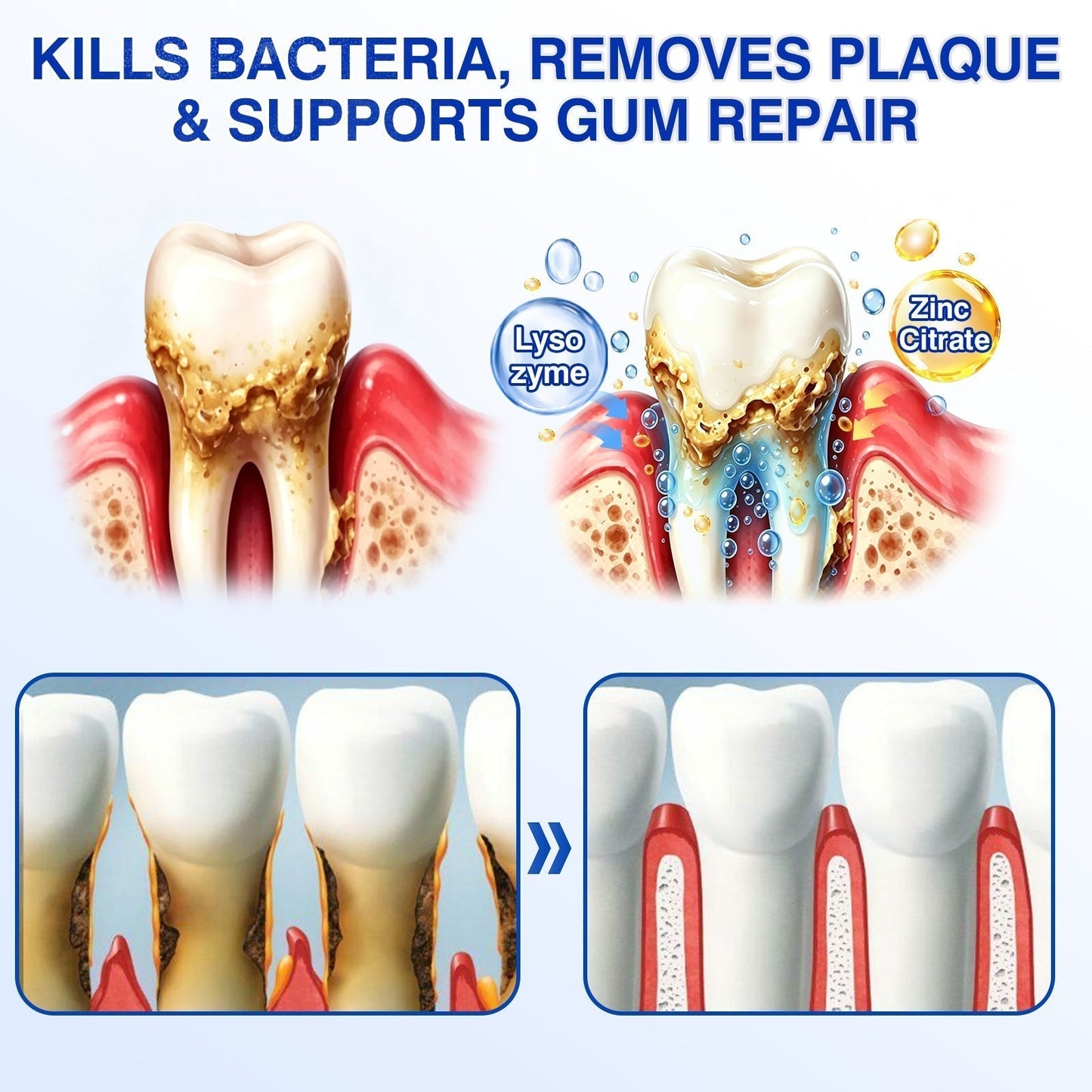 🇬🇧🏆🦷🛡️ Dr.Era® GumRevive Advanced Gum & Periodontal Repair Gel 💫💫