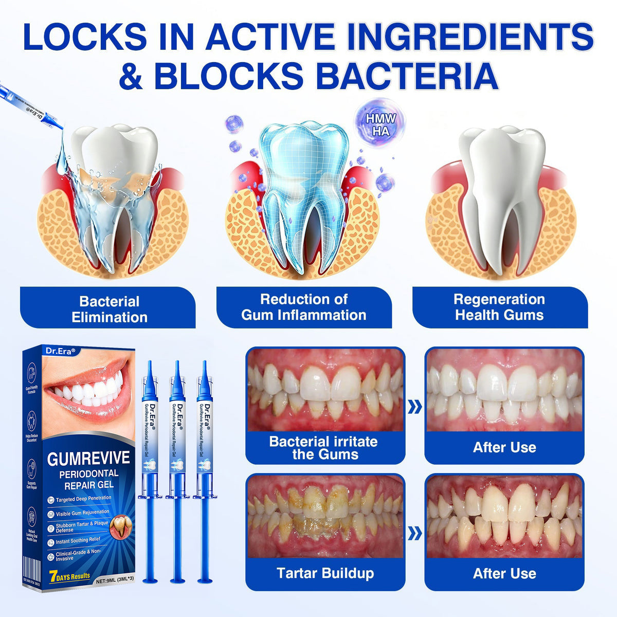 🇬🇧🏆🦷🛡️ Dr.Era® GumRevive Advanced Gum & Periodontal Repair Gel 💫💫