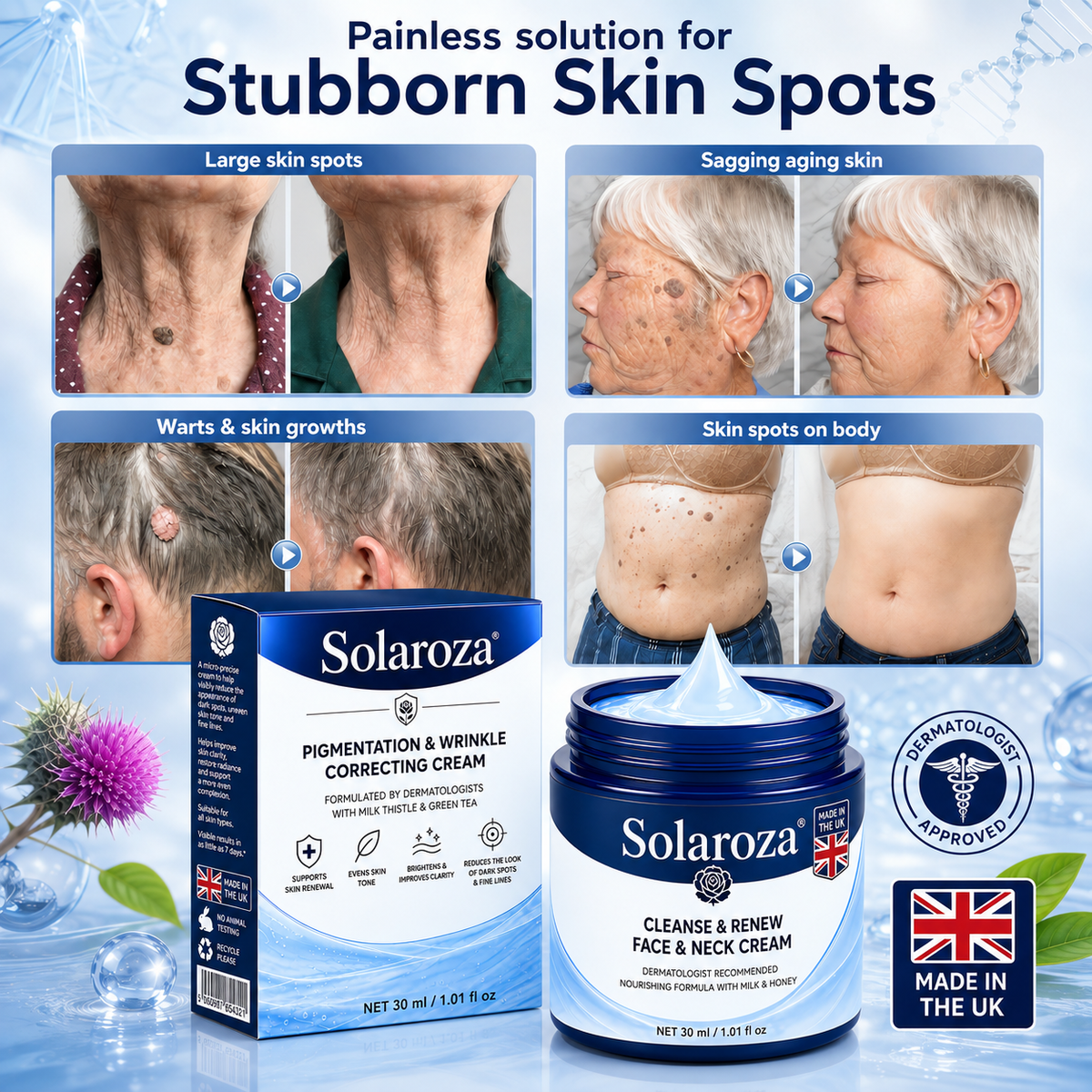 🧑‍⚕️ 𝐒𝐨𝐥𝐚𝐫𝐨𝐳𝐚® 7-Day Skin Tag & Pigmentation Removal Cream (Painless Formula – Scar-Free) 🇬🇧🧊🧊