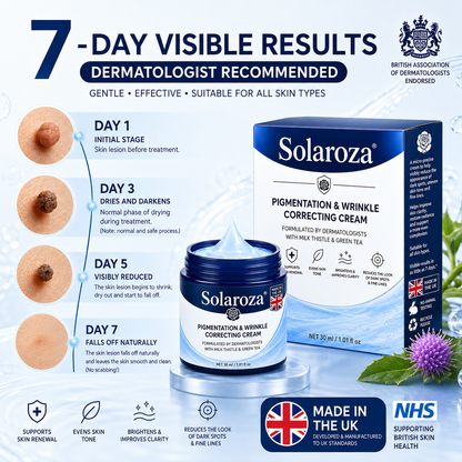 🧑‍⚕️ 𝐒𝐨𝐥𝐚𝐫𝐨𝐳𝐚® 7-Day Skin Tag & Pigmentation Removal Cream (Painless Formula – Scar-Free) 🇬🇧🧊🧊