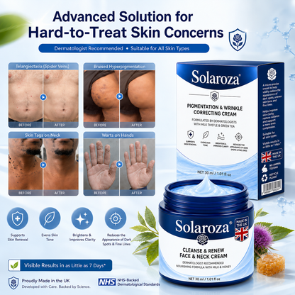 🧑‍⚕️ 𝐒𝐨𝐥𝐚𝐫𝐨𝐳𝐚® 7-Day Skin Tag & Pigmentation Removal Cream (Painless Formula – Scar-Free) 🇬🇧🧊🧊