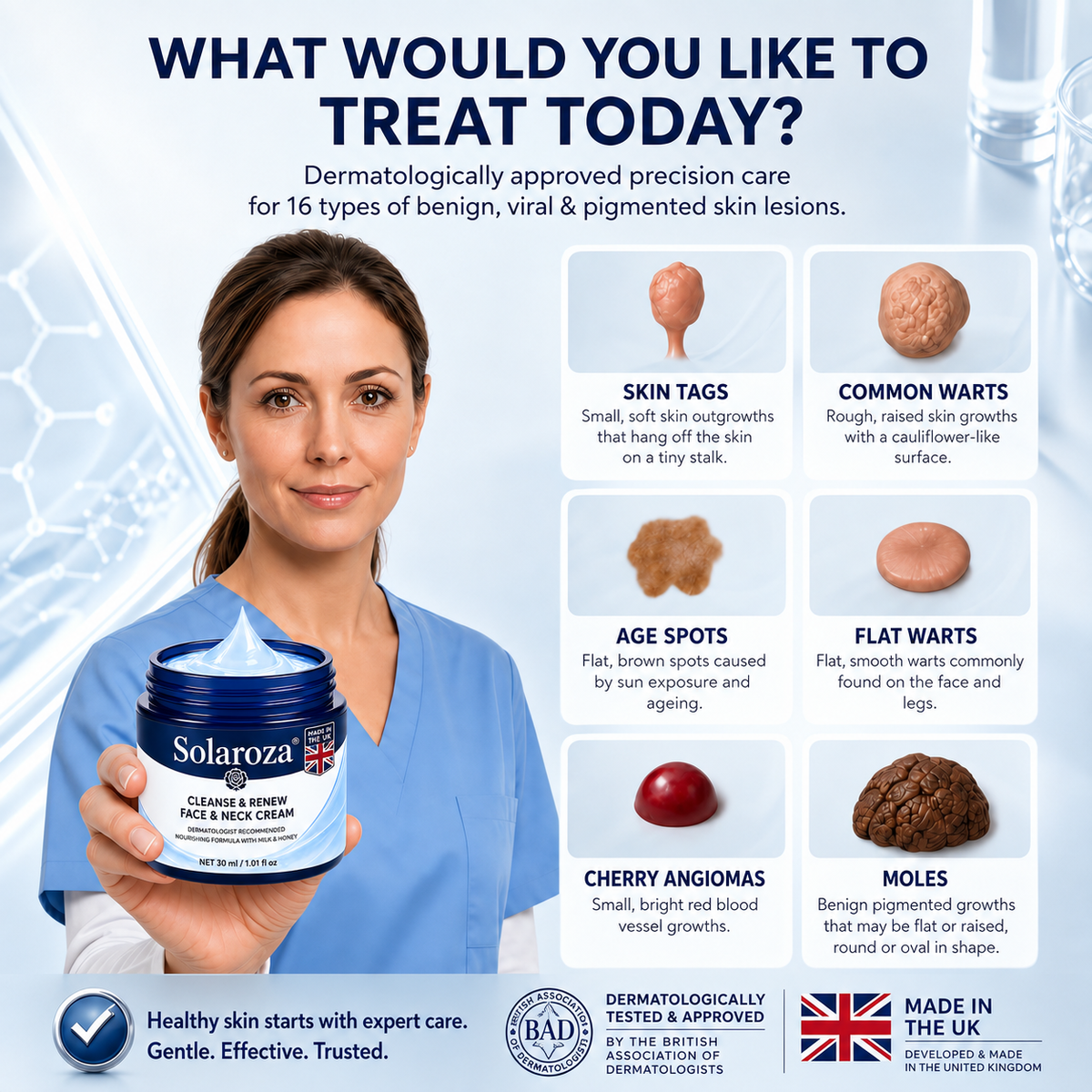 🧑‍⚕️ 𝐒𝐨𝐥𝐚𝐫𝐨𝐳𝐚® 7-Day Skin Tag & Pigmentation Removal Cream (Painless Formula – Scar-Free) 🇬🇧🧊🧊